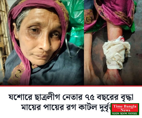 ৭৫ বছরের বৃদ্ধা মায়ের পায়ের রগ কেটে দিল!  এলাকায় চড়ম উত্তেজনা।