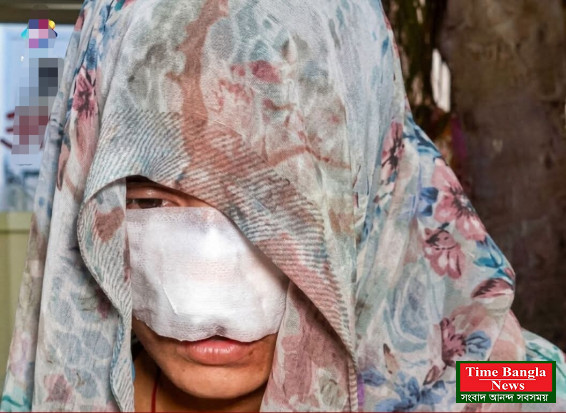 স্বামীর কামড়ে স্ত্রীর নাকে ১০ সেলাই। উপমহাদেশে নির্যাতনের রেকর্ড ভাংলেন স্বামী।