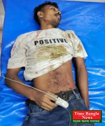 কক্সবাজার থেকে খেলা দেখে বাড়ি ফেরা হল না,মোটর সাইকেল দূর্ঘটনায় প্রাণ গেল আরফাত নামের এক যুবককে !